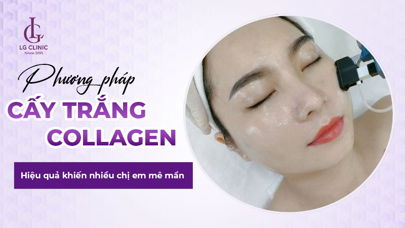 Cấy trắng collagen