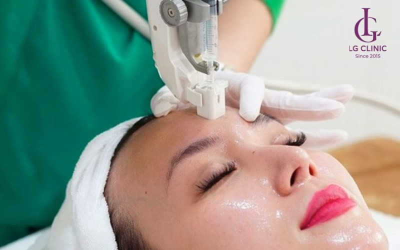 Cấy collagen tươi lên trên da mặt