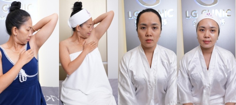 Công nghệ CFU Èlife