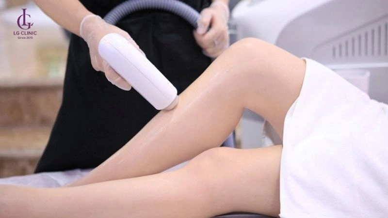 Triệt lông IPL hiệu quả với công nghệ ánh sáng xung an toàn cho da