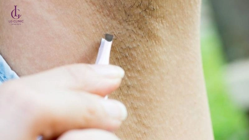 không cạo nhổ, wax lông trước đó 2–4 tuần