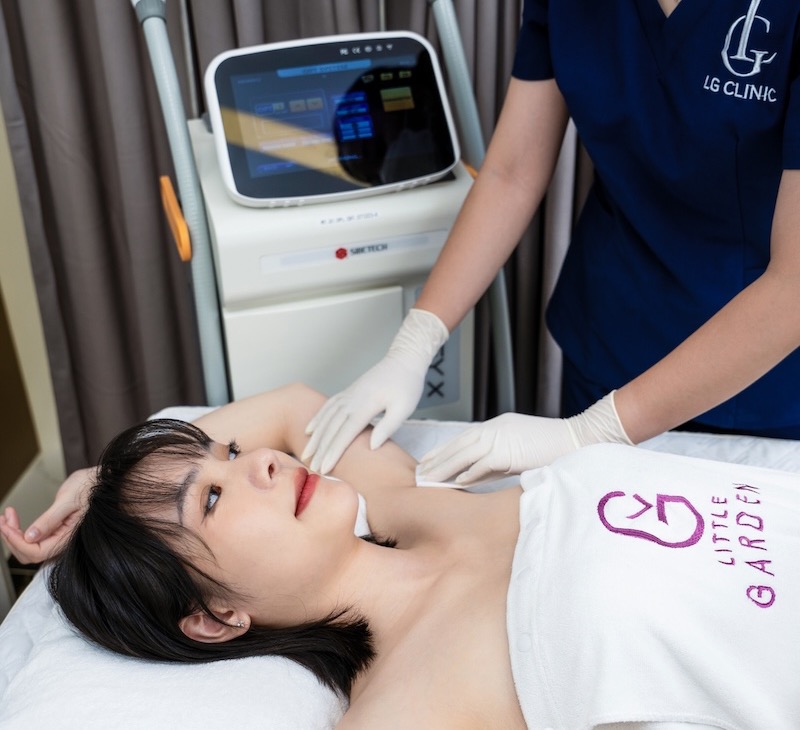 Quy trình triệt lông nách tại Spa