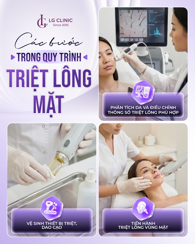 quy trình triệt lông mặt