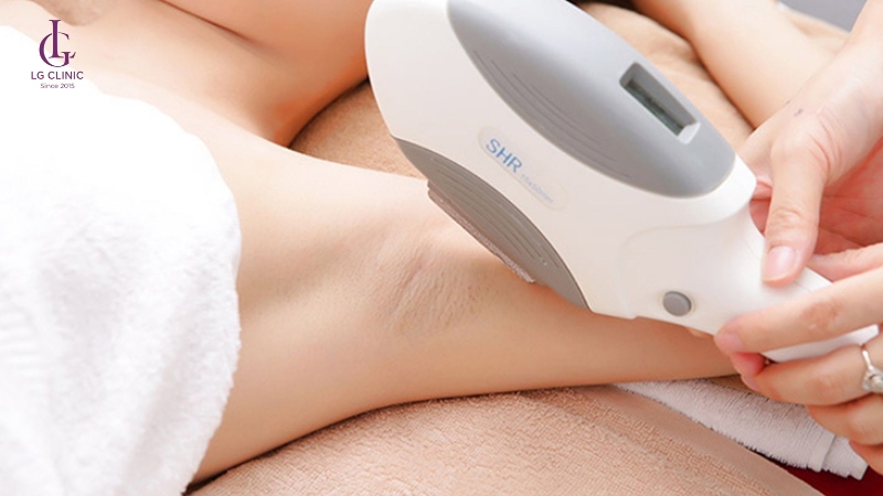 Công nghệ triệt lông OPT