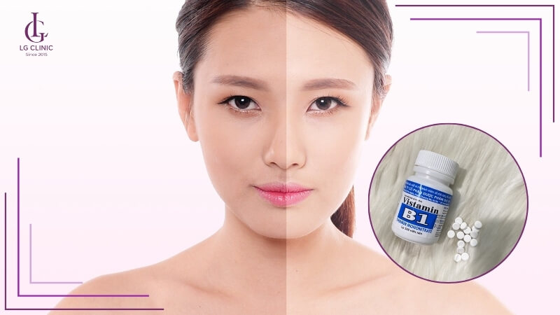 sử dụng vitamin b1 làm trắng da