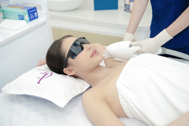 Quy trình triệt lông nách tại Spa