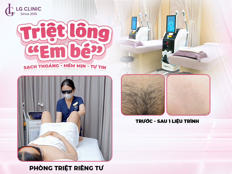 triệt lông bikini