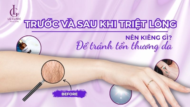 trước và sau khi triệt lông nên kiêng gì