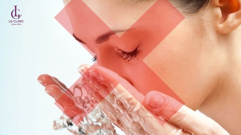 Triệt lông mặt cần kiêng nước để tránh kích ứng và giúp da phục hồi nhanh.