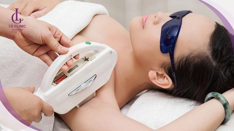 Triệt lông nách với công nghệ LG Cool giúp rút ngắn liệu trình và ngăn lông mọc lại