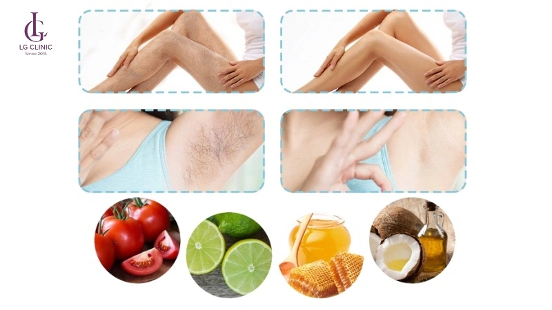 Cách triệt lông tại nhà bằng nguyên liệu tự nhiên