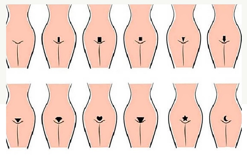 các kiểu mẫu hình ảnh sau khi triệt lông vùng kín có thể làm