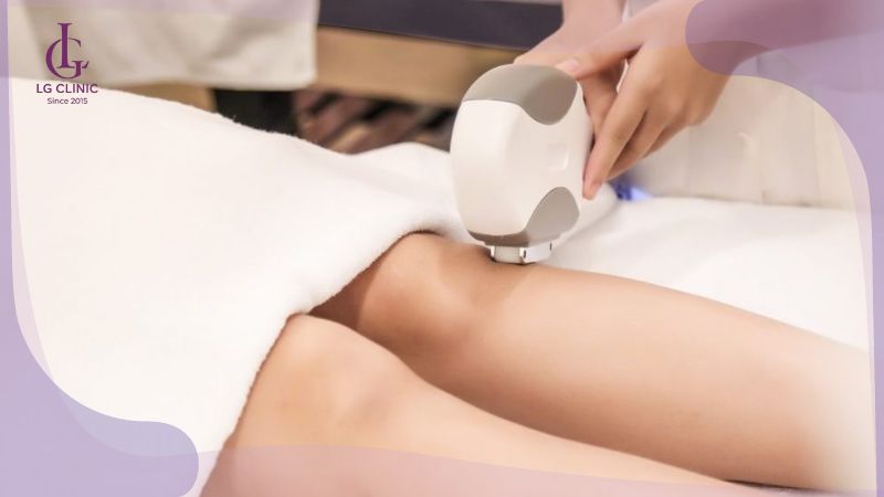 cách làm mềm lông vùng kín bằng laser
