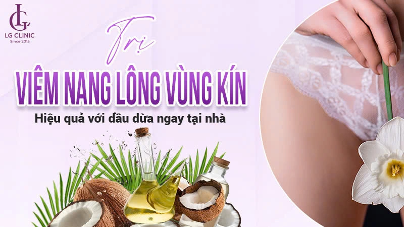 cách trị viêm nang lông vùng kín bằng dầu dừa