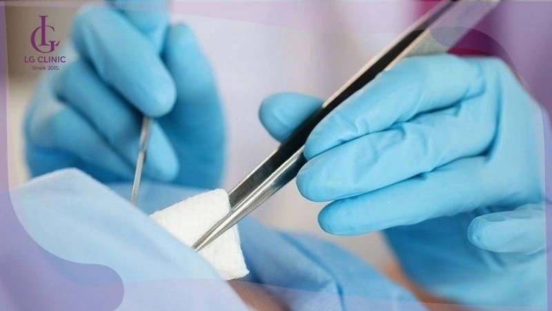 can thiệp phẫu thuật trong trường hợp viêm nang lông nặng