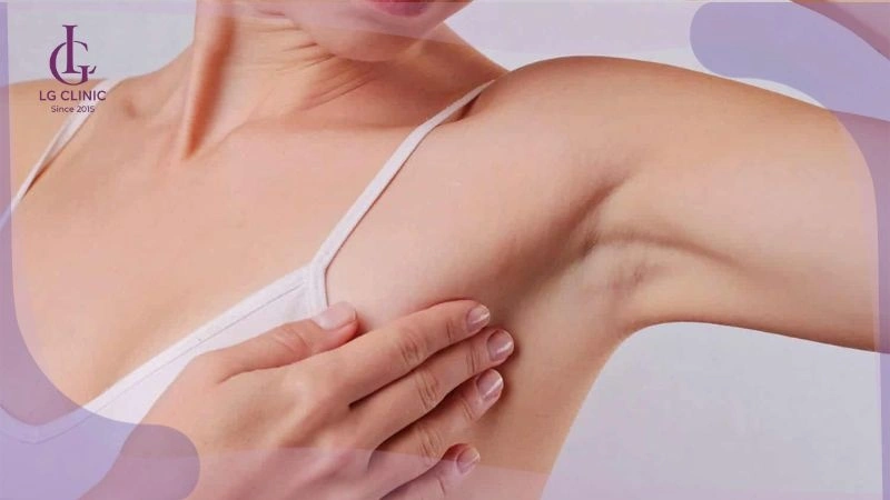 chăm sóc nách sau khi loại bỏ lông nách