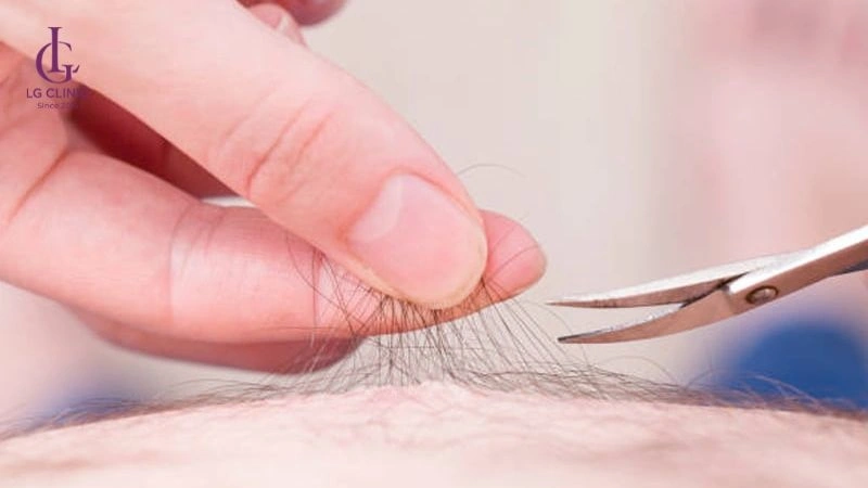 vệ sinh dụng cụ cắt sạch sẽ