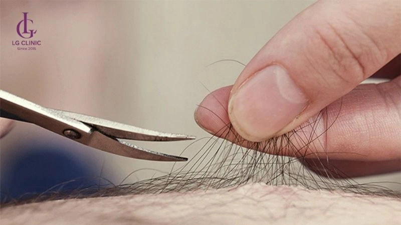 nên tỉa lông vùng kín để không bị nấm