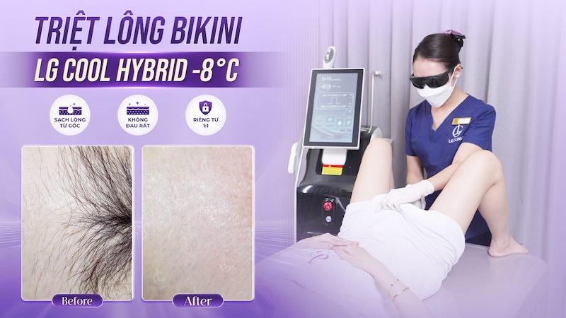 triệt lông vùng kín nữ