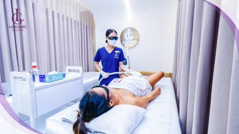 Triệt lông bằng laser