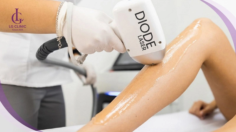 công nghệ triệt lông Diode Laser