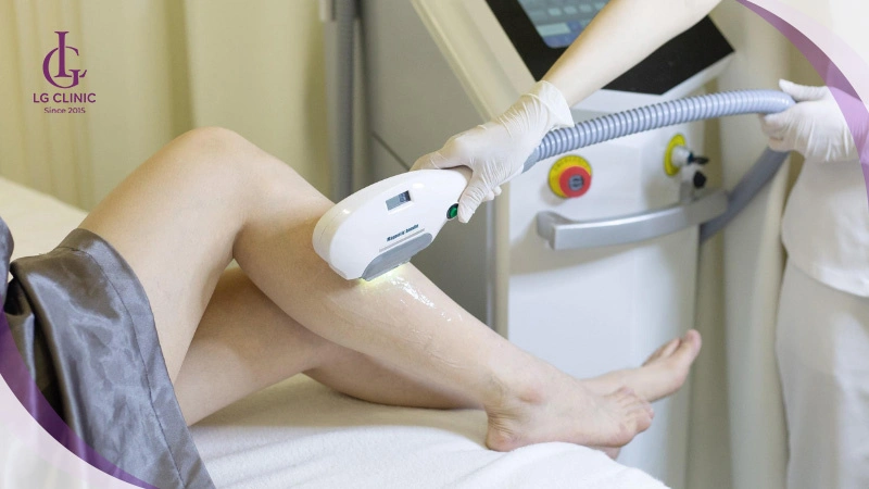 công nghệ triệt lông vĩnh viễn OPT