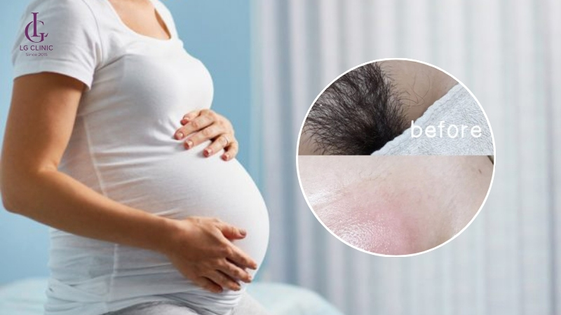 lợi ích kem tẩy lông đối với bà bầu