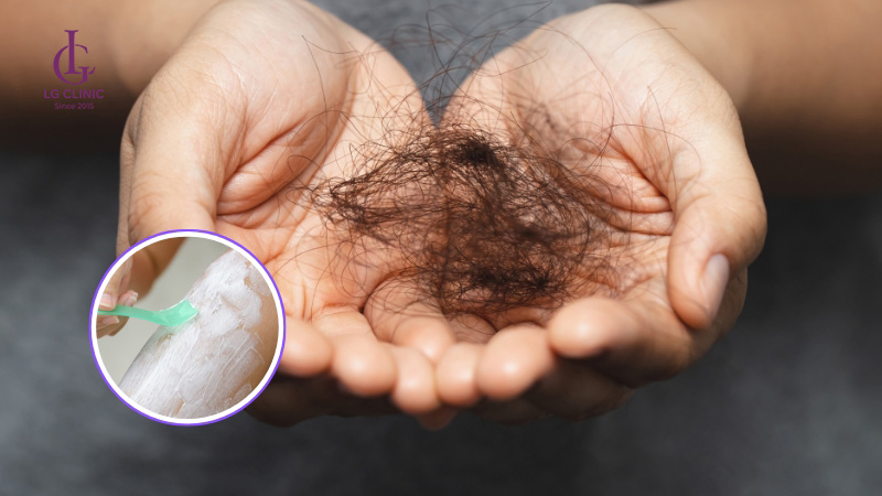 kem tẩy lông vùng kín