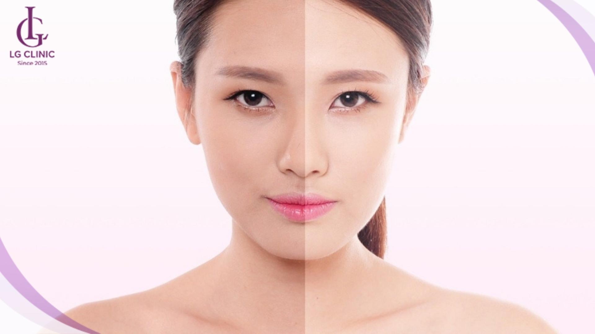 Lưu ý giúp làm trắng da mặt nhanh nhất trong 1 tuần hiệu quả và an toàn