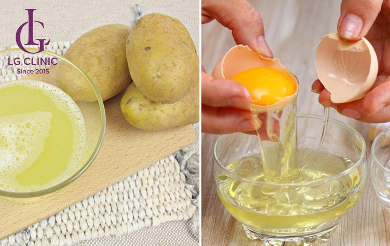 Mặt nạ trứng gà và khoai tây giảm thâm mụn