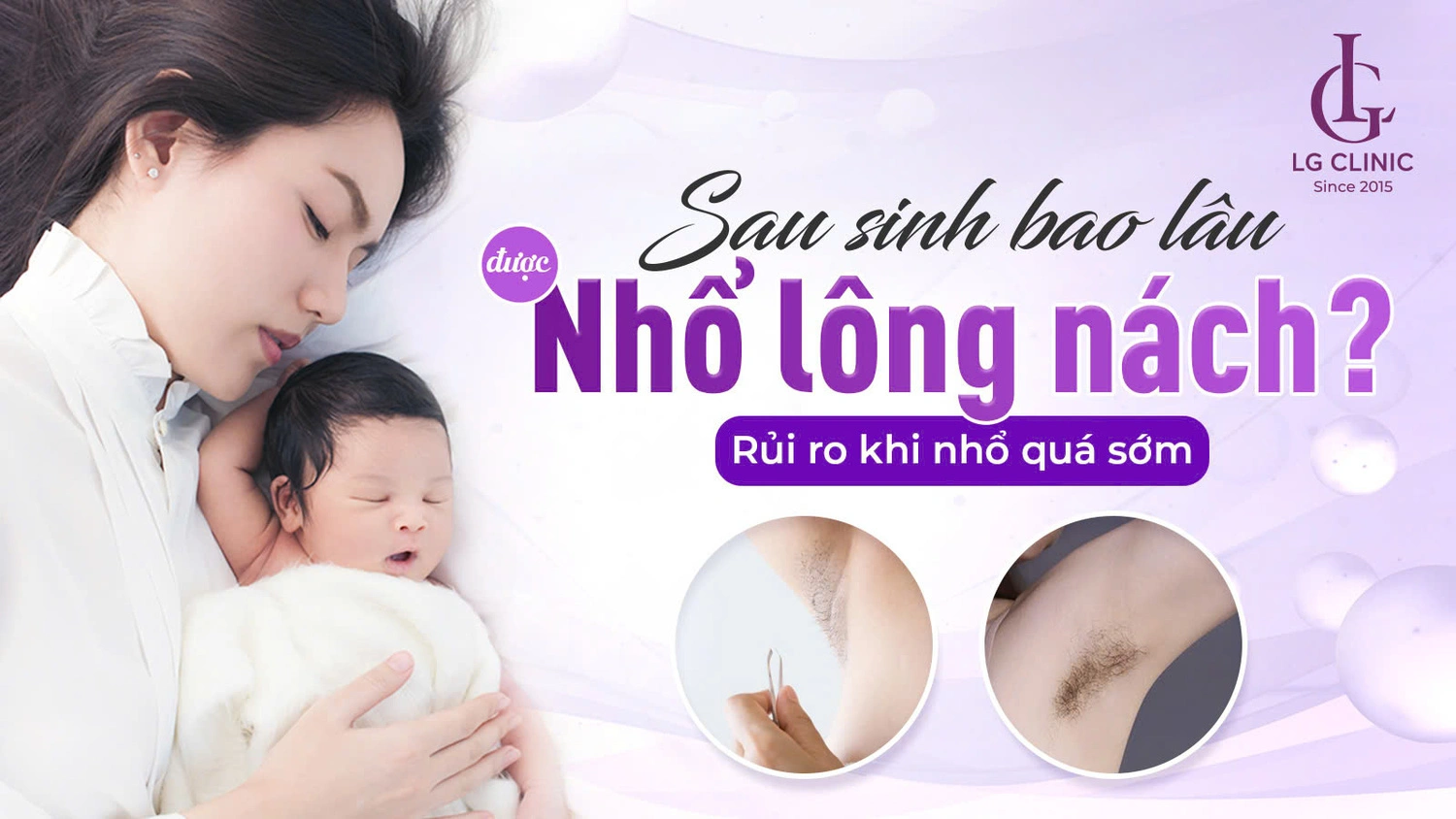 nhổ lông nách sau sinh