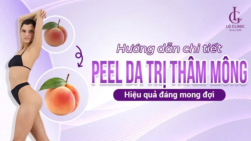 peel da để trị thâm mông