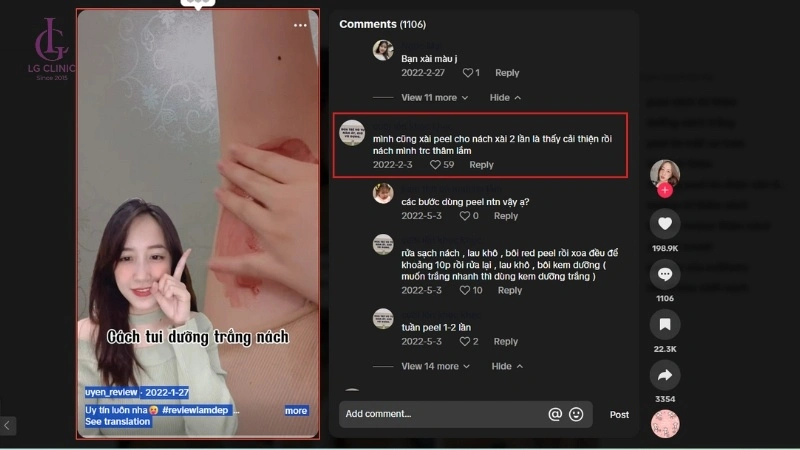Review peel trị thâm nách