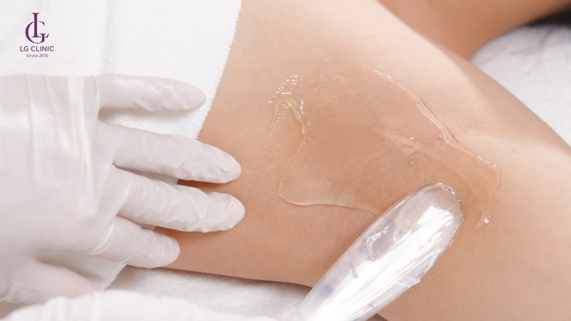 Quy trình triệt lông bằng công nghệ New Elight gồm 7 bước tiêu chuẩn.