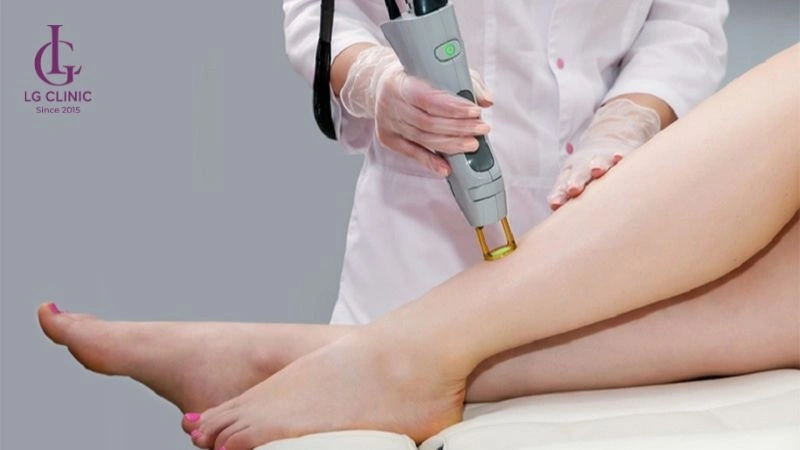 bắn laser trị thâm