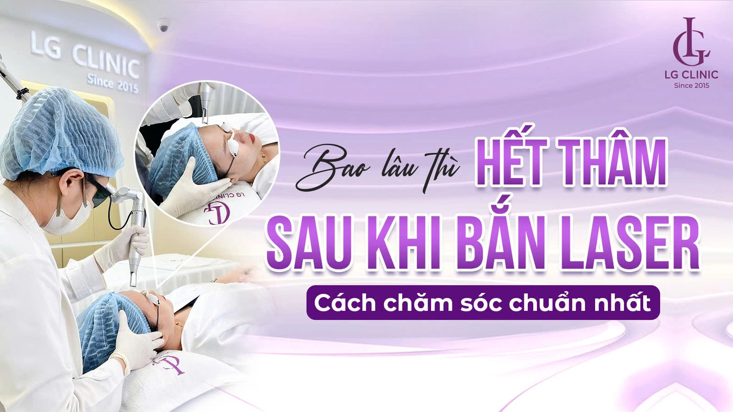 Sau khi bắn laser bao lâu thì hết thâm