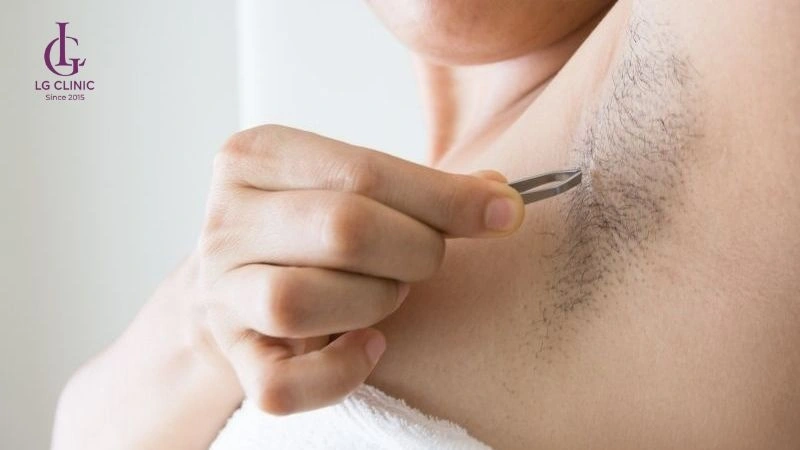 sau sinh bao lâu được nhổ lông nách