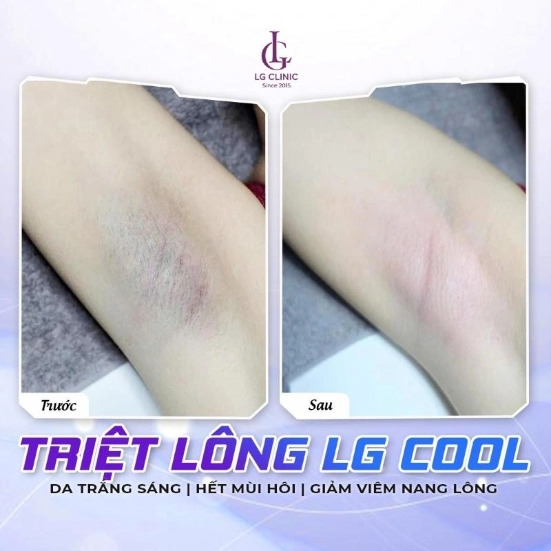 lg cool