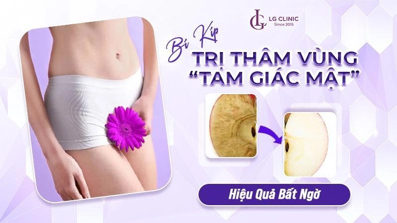 trị thâm vùng kín bằng laser tại lg clinic