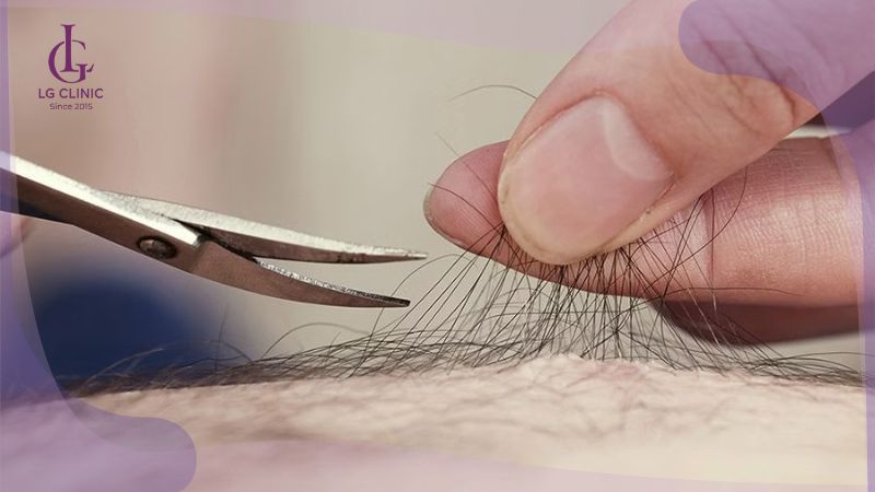 tẩy lông vùng kín an toàn để tránh tình trạng lông mọc ngược