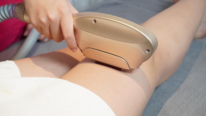 Hiệu quả triệt lông bằng công nghệ New Elight được nhiều người tin chọn.