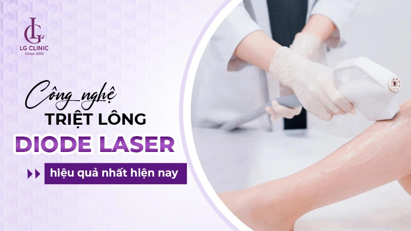 triệt lông nách công nghệ diode laser