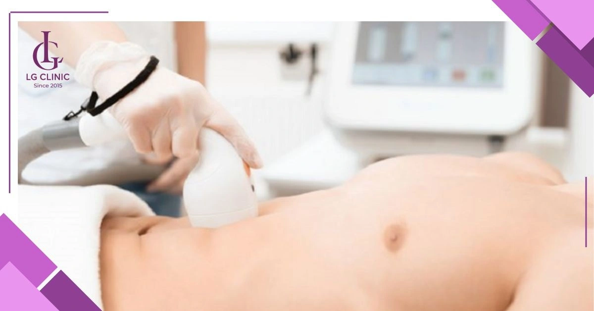 triệt lông đối với nam giới