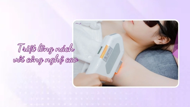 triệt lông nách bằng công nghệ hiện đại