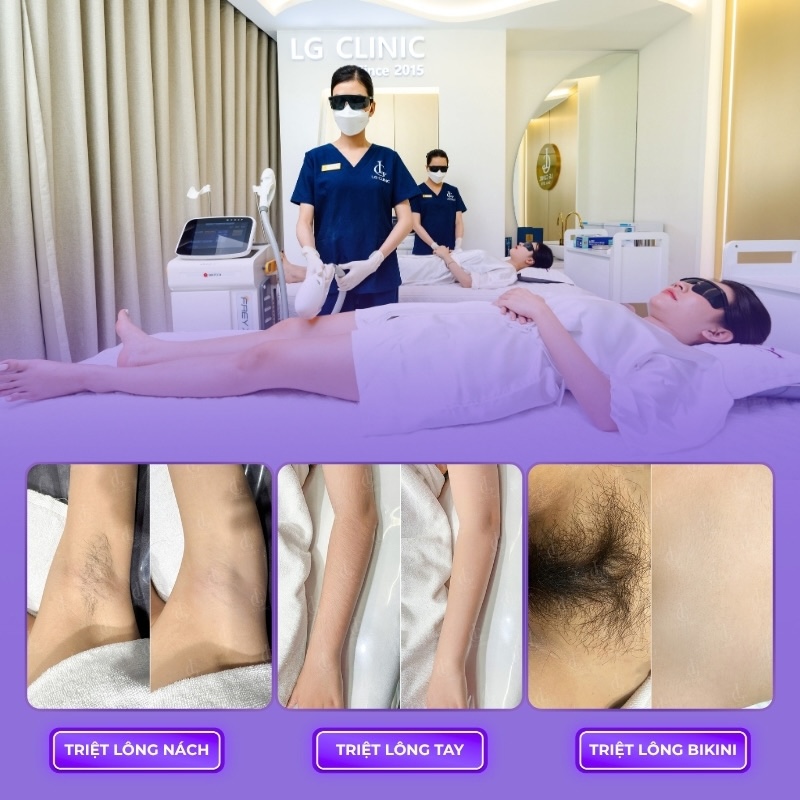 triệt lông lg cool hybrid