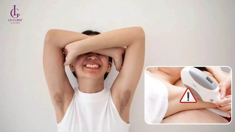 triệt lông tại nhà tuổi 15