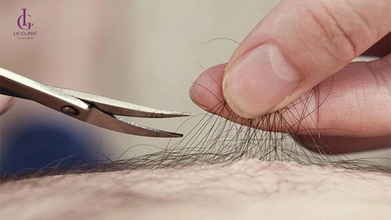 cắt tỉa lông vùng kín bằng kéo