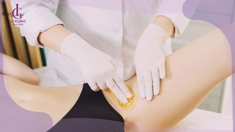 wax lông vùng kín bằng sugaring