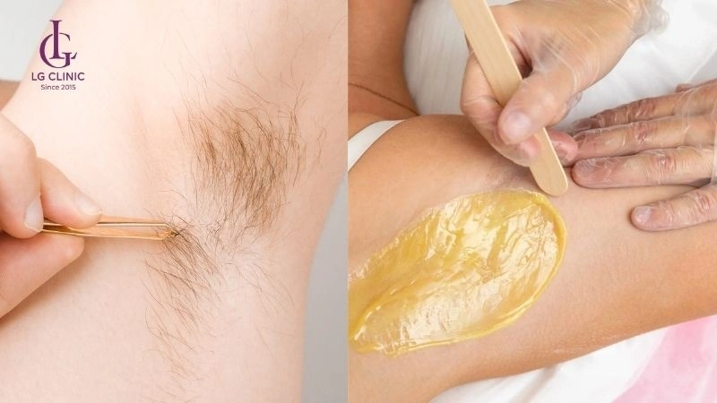 waxing hay nhổ lông có thể đem đến tác hại không mong muốn