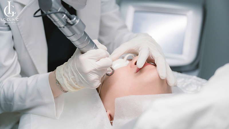 trị thâm mụn bằng laser